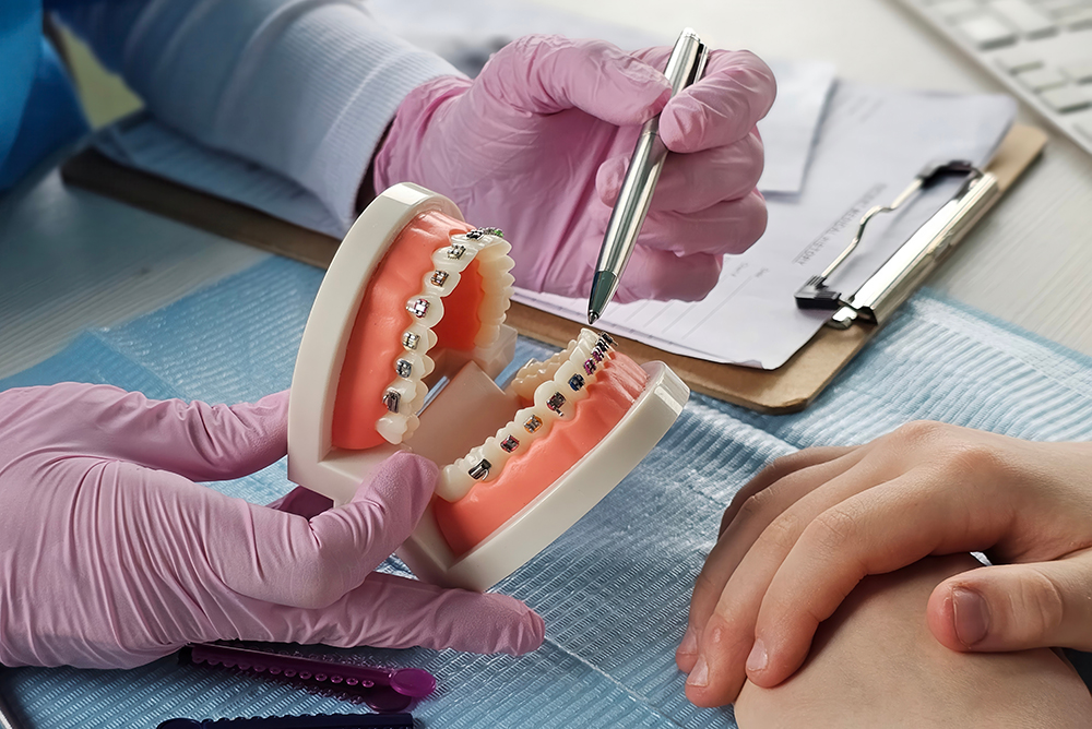 orthodontist explaining treatment using a model of teeth with brackets