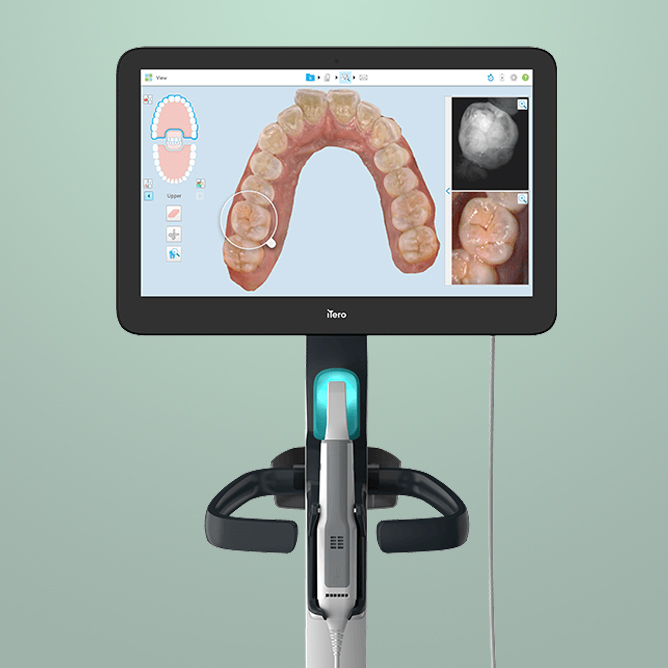 itero scanner on teal background